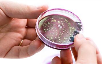 Bacteria in prostate secretion